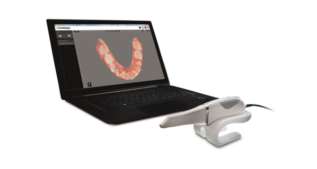 Telecamera intraorale